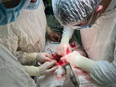 От рака спасли пациентку липецкие медики