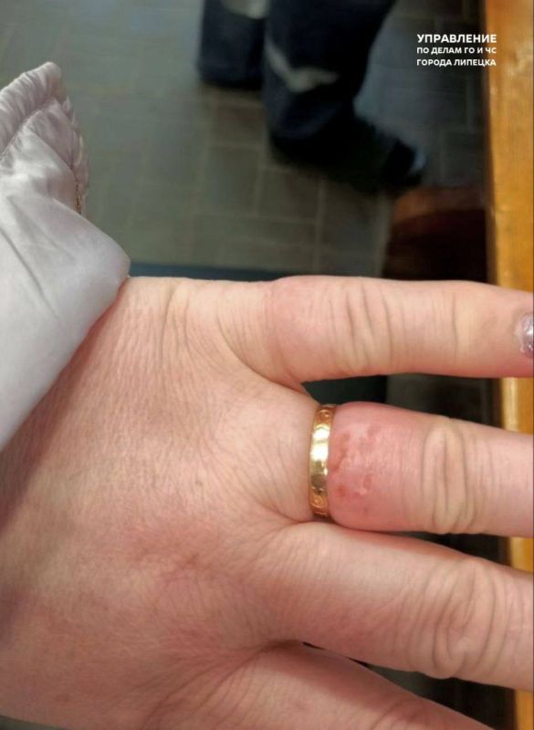 Кольца с пальцев липчан трижды за неделю снимали спасатели
