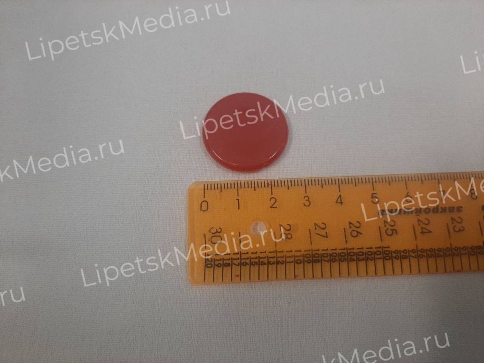 Пластиковую линзу проглотил ребёнок на логопедическом занятии