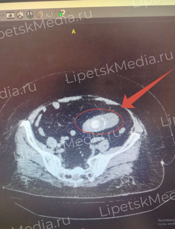 ���������� ������� ������ ������� �� ��������� �����������