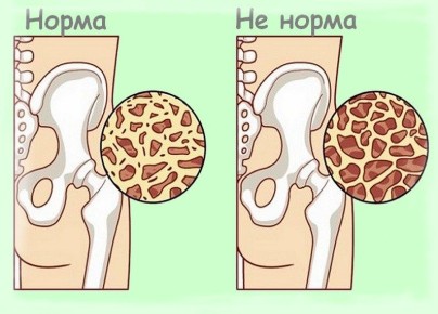 ��� �������� ����� ����� 55: ������� ��������