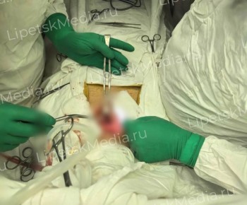 Свободно дышать смог липчанин благодаря уникальной операции