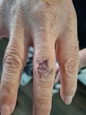 ��������� ������� ��������� ���� 55-������ ���������� �� ��-�� ��������������� ��������