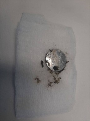 ���������� ������� �� �� ���������� ������� ���������, ������� ������� � �� � ������