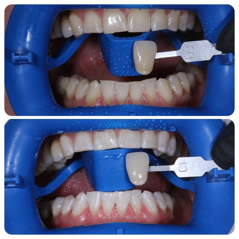 ��� ��������� �������� �����: ������ �� ����� � ������������