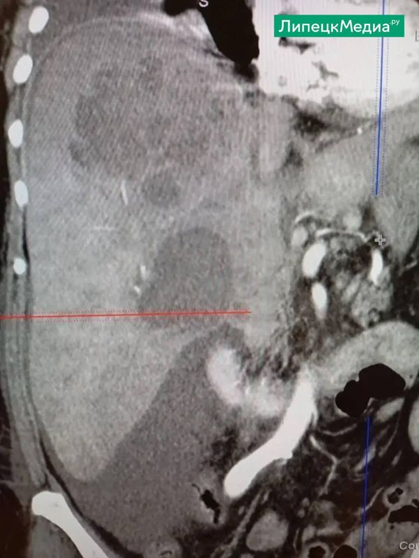 � �������� �������� �� ����� ���������� ��������