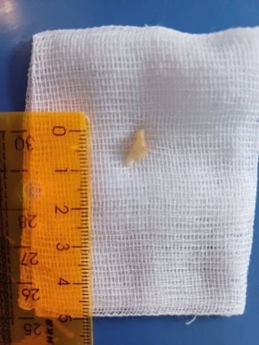 ������� ������ �������� ��� � ����� ����������� ������� �� �����